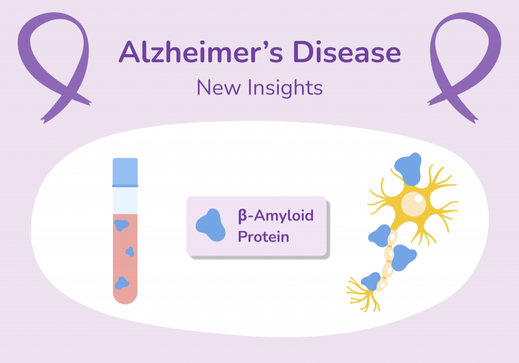 Sept 2023 Newsletter Alzheimer Disease (1)