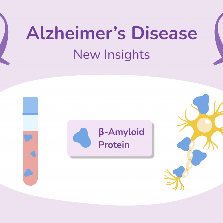 Sept 2023 Newsletter Alzheimer Disease (1)