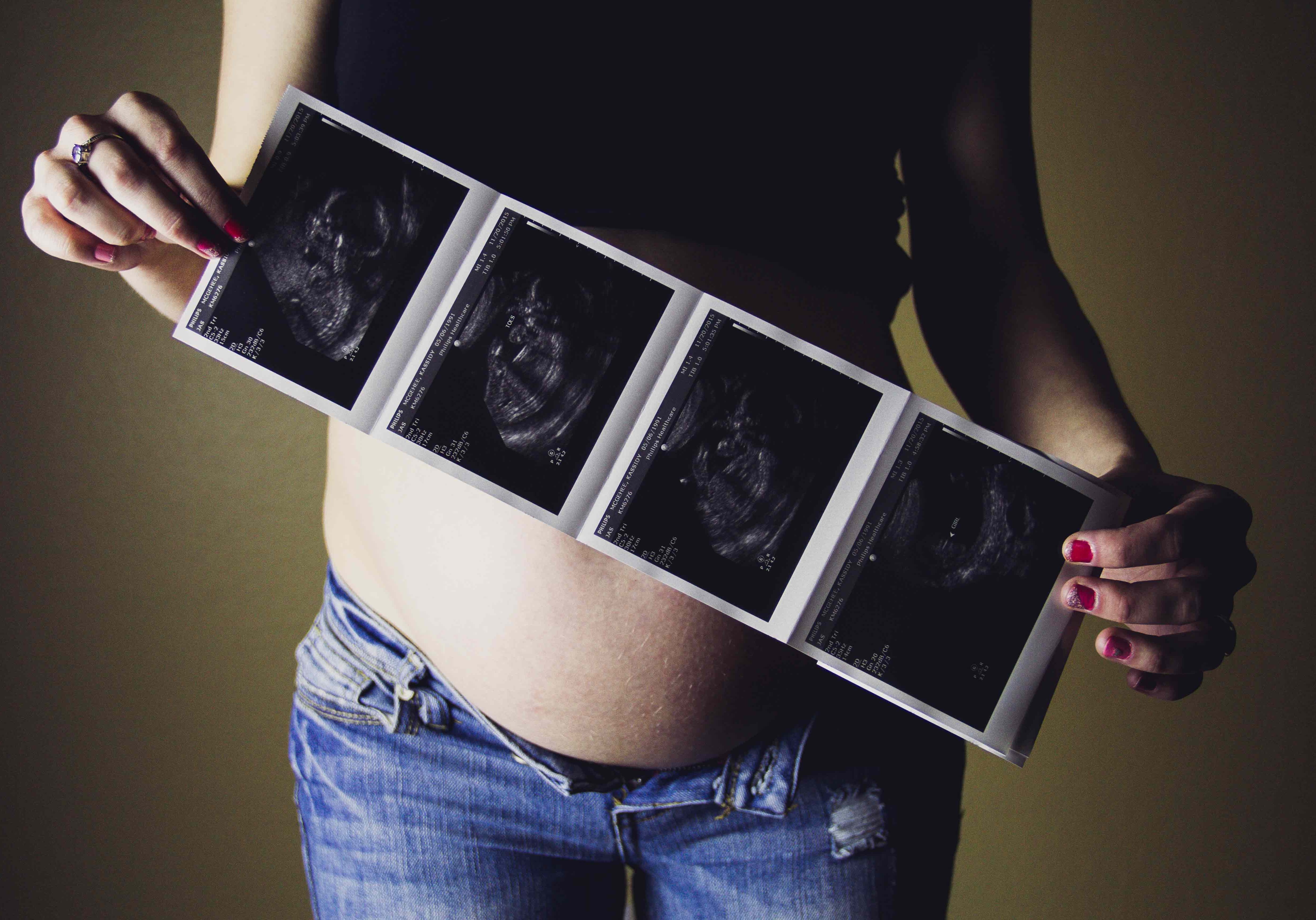 pregnant woman standing alone with ultrasound images