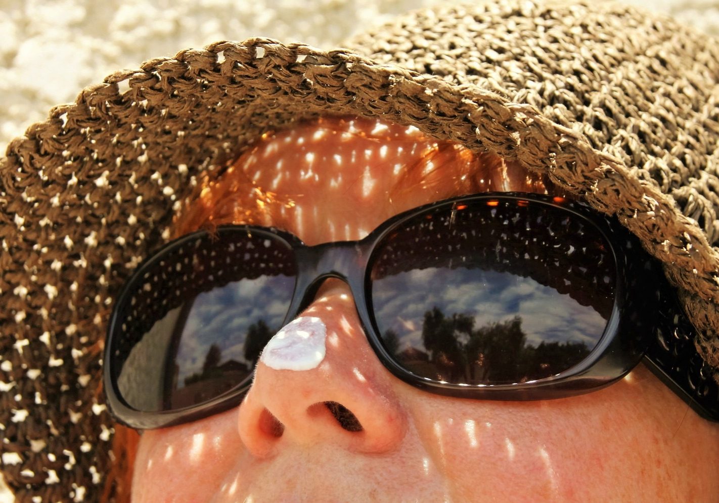 person wears hat, sunglasses, and sunscreen for protection against skin cancer